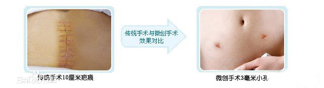 �¹�WOLF����ǻ��